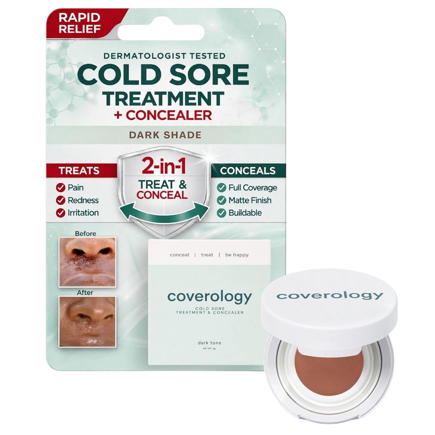 Cold Sore Treatment & Concealer
