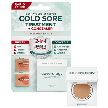 Cold Sore Treatment & Concealer