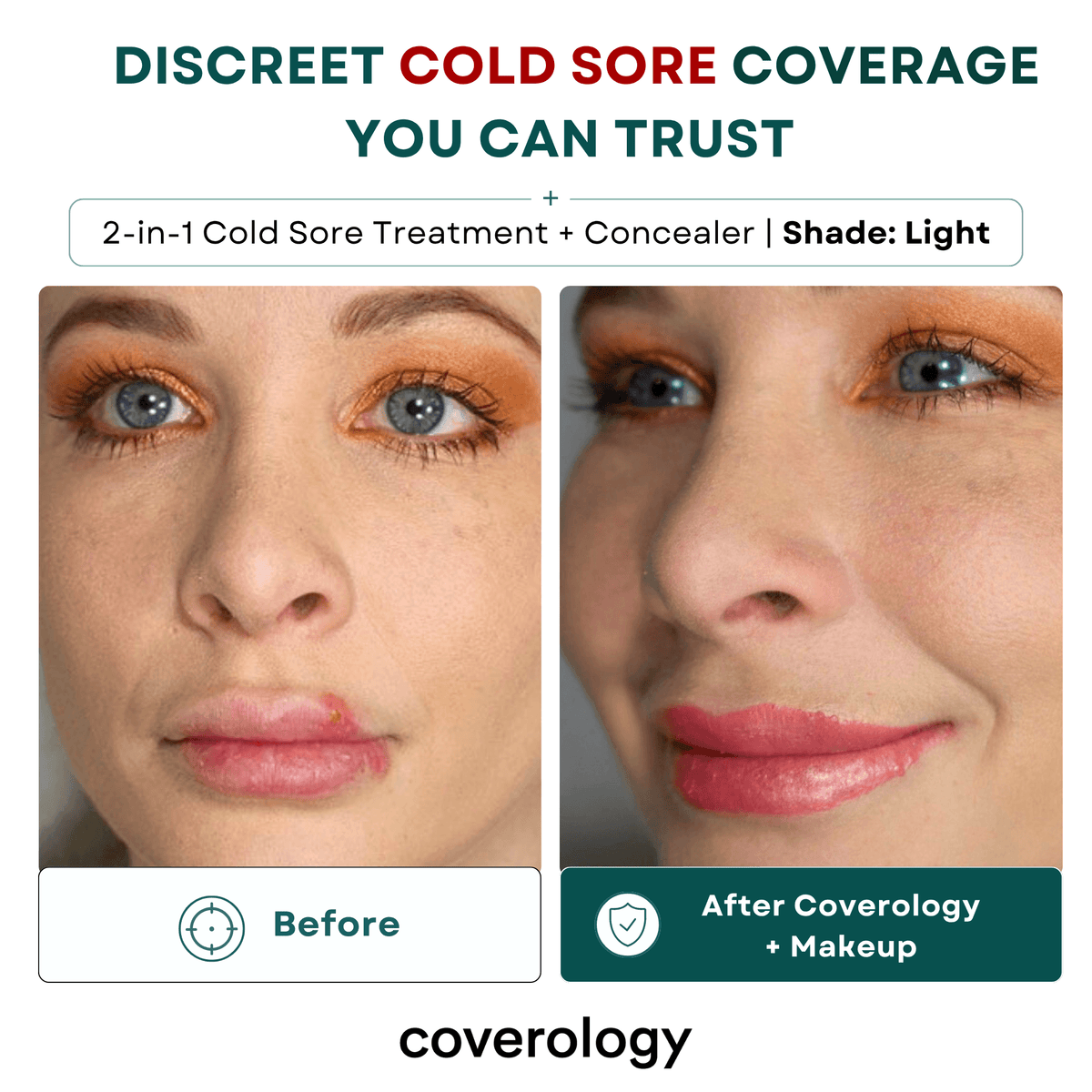 Cold Sore Treatment & Concealer