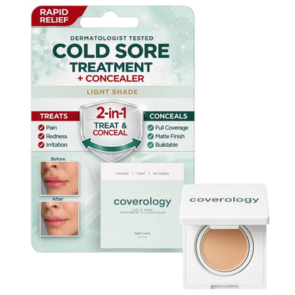 Cold Sore Treatment & Concealer