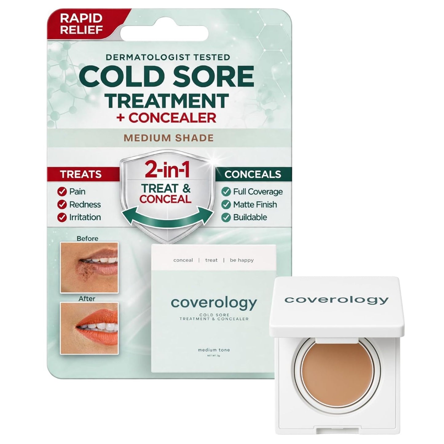Cold Sore Treatment & Concealer